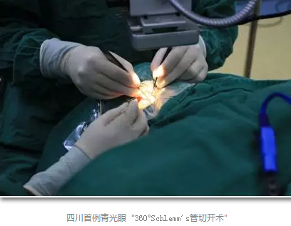 成都8868体育(中国)官方网站 - 登录入口已经开展的青光眼手术有：引流阀 (钉)植入手术(2015年以来已200多 )，360°Schlemm's管切开术，激光CO2 辅助巩膜深层切除术，小梁切除术青(光眼)白(内障)联合手术。还有虹膜周切术、前房成形术、 虹膜复位术，睫状体冷冻术，小梁切开术和前房穿刺术等6.png