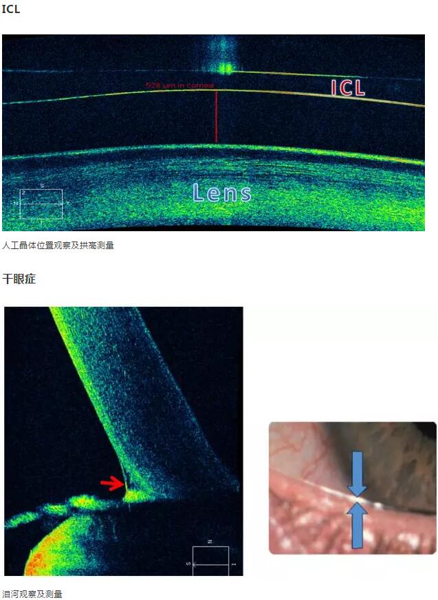 8868体育官网入口课堂：后节频域OCT前节模块的运用15.jpg