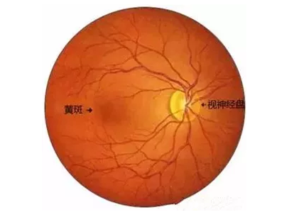 8868体育官网入口福州眼科医院眼底病医生：老年黄斑变性该如何防治？.png