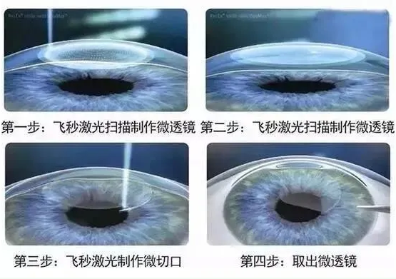 2021年征兵准备工作已经全面展开，视力不够的看过来2.png