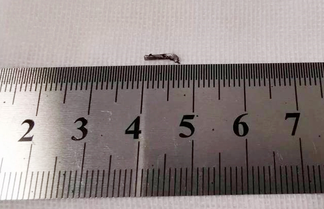 8868体育官网入口徐州复兴眼科王海菊：妙手拨迷障，匠心护光明3.png